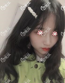 李任主任給我手術(shù)完兩個月了 李任主任給我手術(shù)完兩個月了