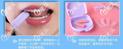 隱形牙套必備的咬膠