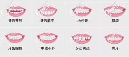 你的牙齒有這些問題嗎 你的牙齒有這些問題嗎