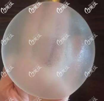 法國伊思雅隆胸假體優(yōu)缺點