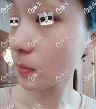 還有點小斑點 還有點小斑點