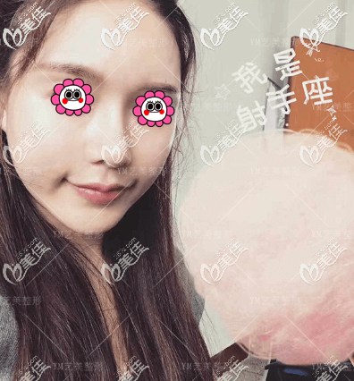 親身體驗(yàn)一針降顴弓技術(shù)感覺蠻有用的,順便和你聊聊優(yōu)缺點(diǎn)和維持時(shí)間