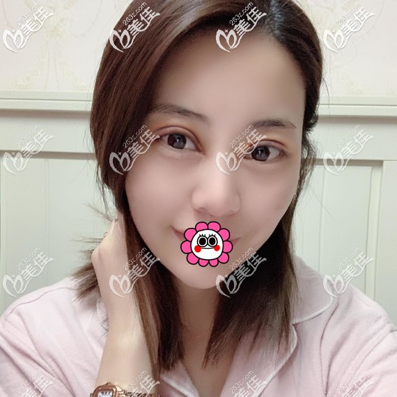 術(shù)后恢復(fù)7天拆線 術(shù)后恢復(fù)7天拆線