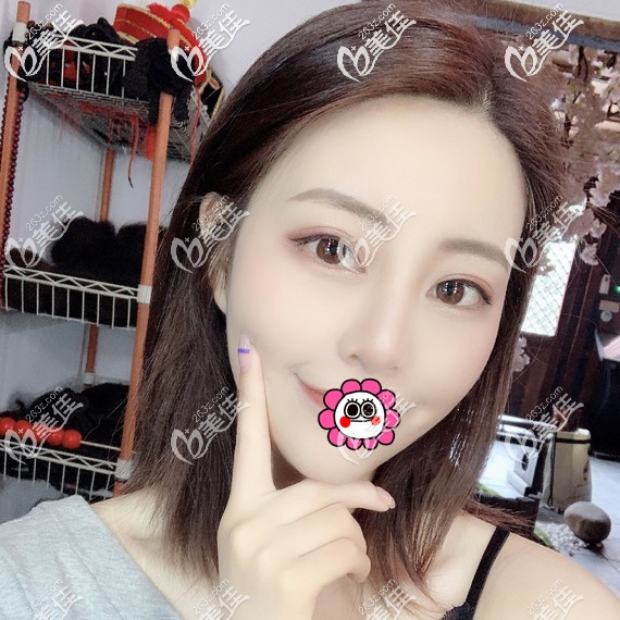 不用考慮隆鼻和雙眼皮先做哪個(gè)，來(lái)看看一起做的改善有多大