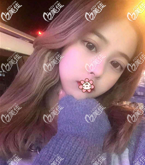 兩個(gè)月后臉小了好多