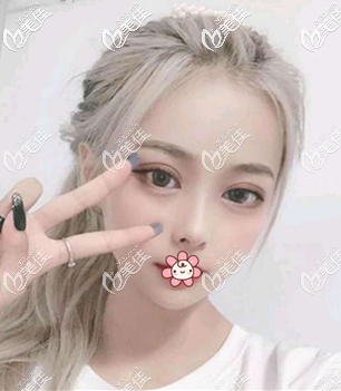 有過面部輪廓三件套和全臉脂肪填充經(jīng)歷我就知道泰國曼谷雨季整形怎么樣了