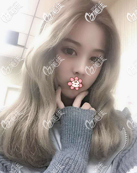 泰國(guó)曼谷雨季做自體脂肪面部填充怎么樣