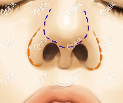 鼻頭的組成部分