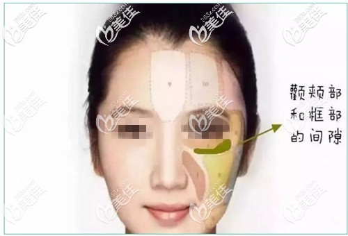 印第安酒窩的位置 印第安酒窩的位置