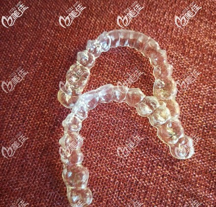 常德美奧口腔隱適美隱形牙齒矯正器 常德美奧口腔隱適美隱形牙齒矯正器