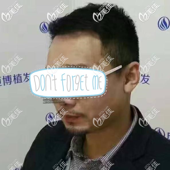 都沒打聽種植胡子要多少錢,我就到成都恒博種胡子植發(fā)際線了