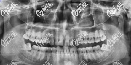 口腔拍片ct南昌維樂口腔 口腔拍片ct南昌維樂口腔