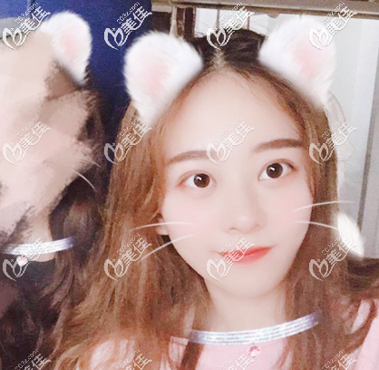 看廣州美萊劉志坤做雙眼皮怎么樣