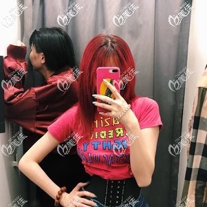 手臂抽脂半個(gè)月沒有細(xì)是正常 只需耐心等2個(gè)月就能告別蝴蝶袖