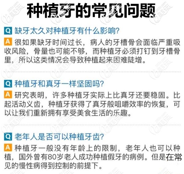 種植牙常見的問題