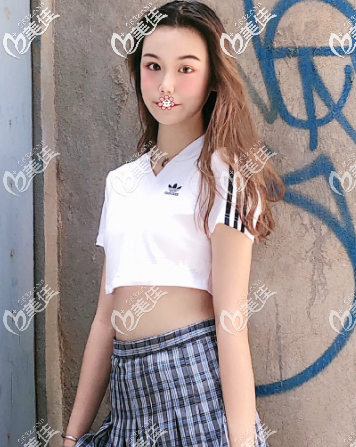 3個(gè)月完全恢復(fù)好了