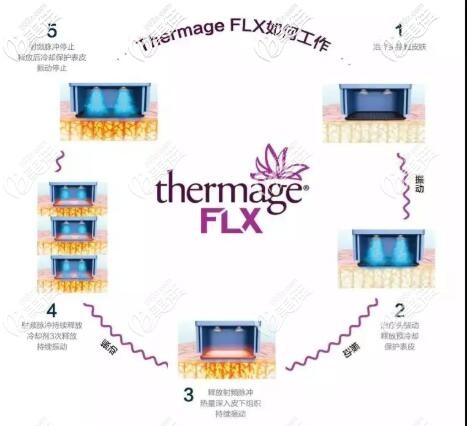 星美極除皺抗衰原理和工作流程說明