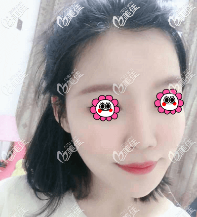 親身體驗(yàn)北京藝美王東不開刀去頜角手術(shù)感覺醫(yī)院不僅正規(guī)也挺可靠的