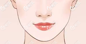 流暢的下頜緣線條