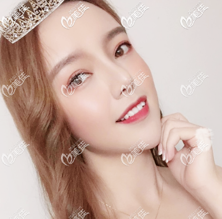 看廣州美萊張毓吸脂技術(shù)怎么樣 看廣州美萊張毓吸脂技術(shù)怎么樣