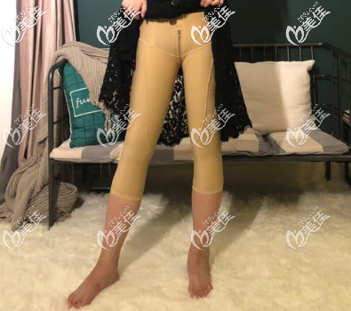 在煙臺(tái)鵬愛(ài)做手術(shù)后的第2天