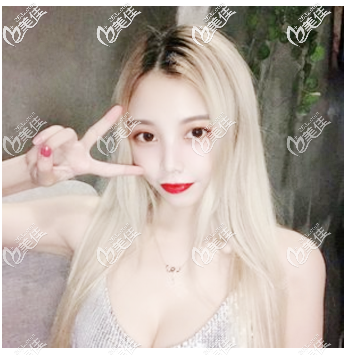 看我的隆胸案例就知道許揚(yáng)濱隆胸技術(shù)真的太好了 看我的隆胸案例就知道許揚(yáng)濱隆胸技術(shù)真的太好了