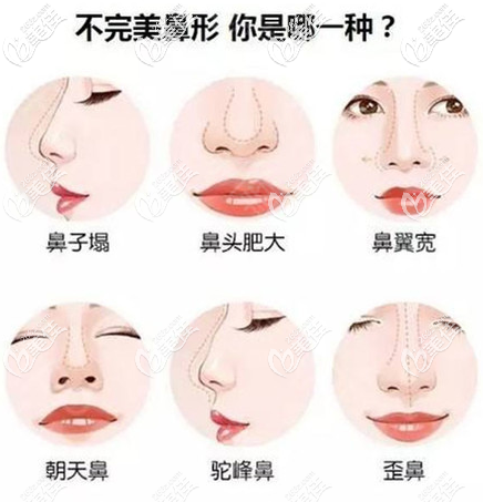 不同鼻子形態(tài)