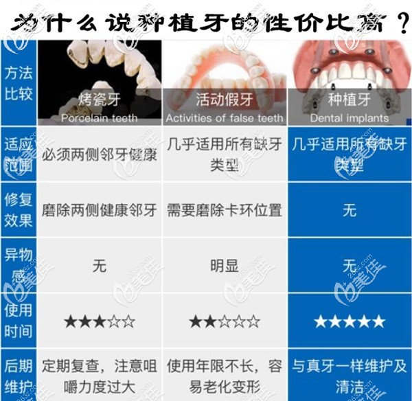 <!--<i data=20240703-sp></i>-->口腔種植牙優(yōu)勢(shì) <!--<i data=20240703-sp></i>-->口腔種植牙優(yōu)勢(shì)