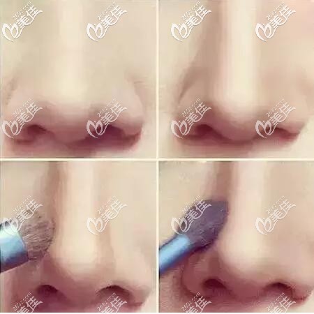 通過鼻影改變鼻型 通過鼻影改變鼻型