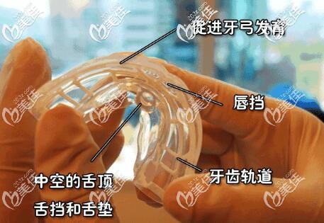 mrc早期干預(yù)矯正 mrc早期干預(yù)矯正