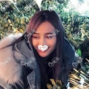 25歲皮膚松弛下垂做美國快翎線提升 術(shù)后一周用肉眼就能看到皮膚更細(xì)膩緊致