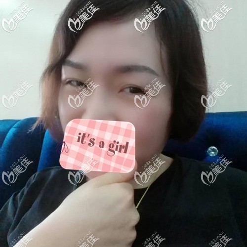 眉毛種植術后2個月進入脫落期