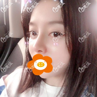 術(shù)后一個月打卡