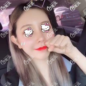 臉上肉多是吸脂好還是打溶脂針好？到醫(yī)院面診后醫(yī)生說(shuō)還是做面部吸脂好一點(diǎn)