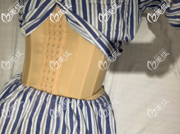 在青島諾美德做腰腹吸脂手術(shù)后的第三天 在青島諾美德做腰腹吸脂手術(shù)后的第三天