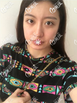 原來(lái)我下巴特寬 原來(lái)我下巴特寬