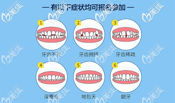 所以牙齒畸形都可參與活動哦 所以牙齒畸形都可參與活動哦