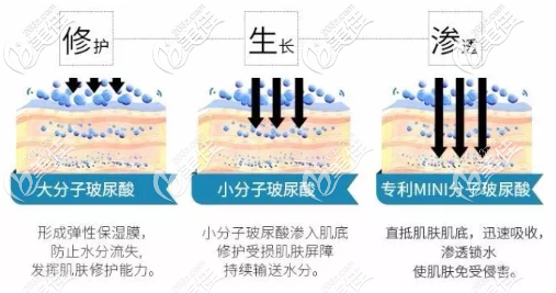 學會看玻尿酸交聯(lián)劑 學會看玻尿酸交聯(lián)劑