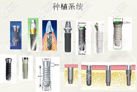 國產(chǎn)和進口的各品牌種植體示意圖