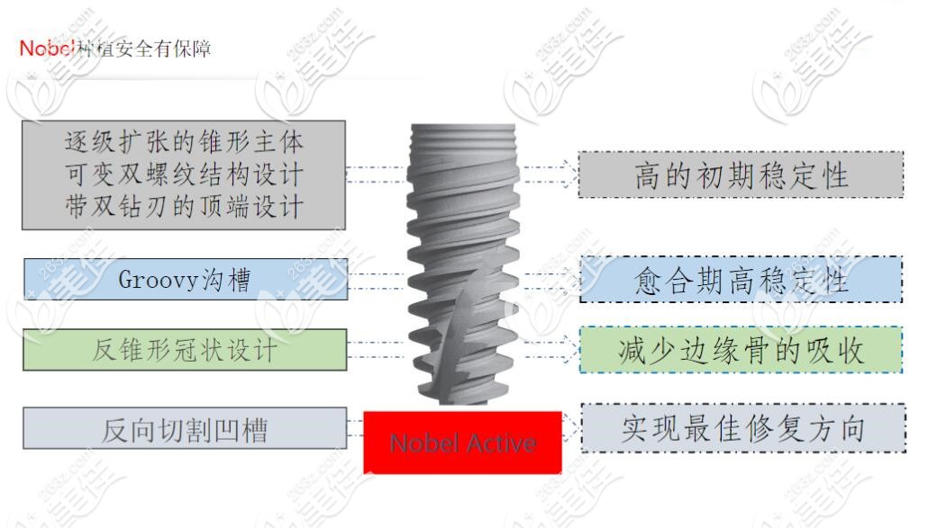 南京美奧口腔諾別爾active種植系統(tǒng)特點(diǎn)