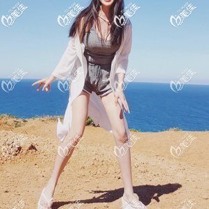 雖然找寧波壹加壹郭光燁做大腿吸脂瘦了不少，但以后也要注意飲食習(xí)慣