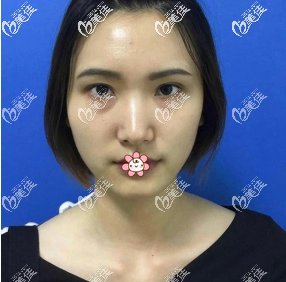 我術(shù)前 我術(shù)前