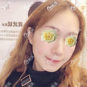 熱瑪吉美膚術(shù)后第3天照