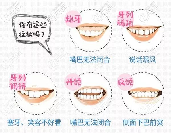口腔許曉萌介紹牙齒矯正的步驟和流程 口腔許曉萌介紹牙齒矯正的步驟和流程