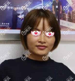 做超體隆鼻術(shù)前照 做超體隆鼻術(shù)前照