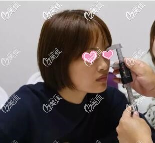 隆鼻術(shù)前肖征剛院長(zhǎng)面診 隆鼻術(shù)前肖征剛院長(zhǎng)面診