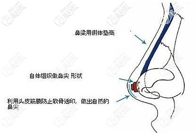 在鼻尖墊筋膜的作用