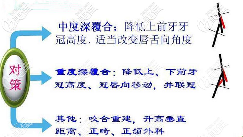 深覆合矯正時的對策 深覆合矯正時的對策