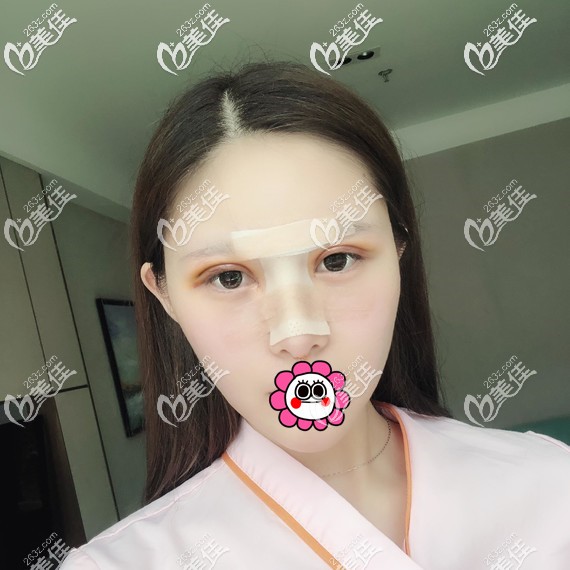 恢復(fù)7天到醫(yī)院拆線 恢復(fù)7天到醫(yī)院拆線