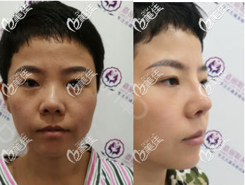 20200629_1593423659909850.png blob.png